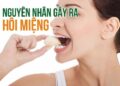 Nguyên nhân và cách chữa hôi miệng