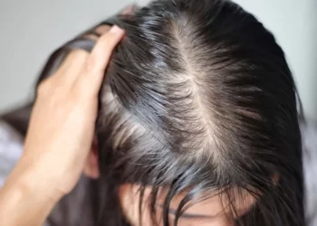 Cách cải thiện mái tóc thưa mỏng