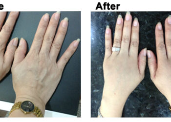 Cách chăm sóc da tay trắng mịn